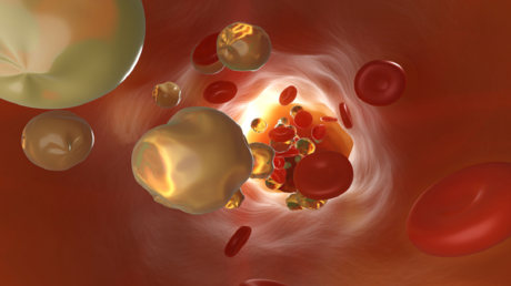 حقنة واحدة تقضي على الكوليسترول؟